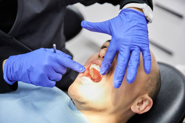Best Emergency Dentist for Knocked-Out Tooth in USA